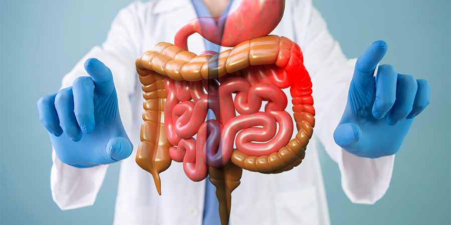 Tips for Dealing with Flare-Ups in Inflammatory Bowel Disease